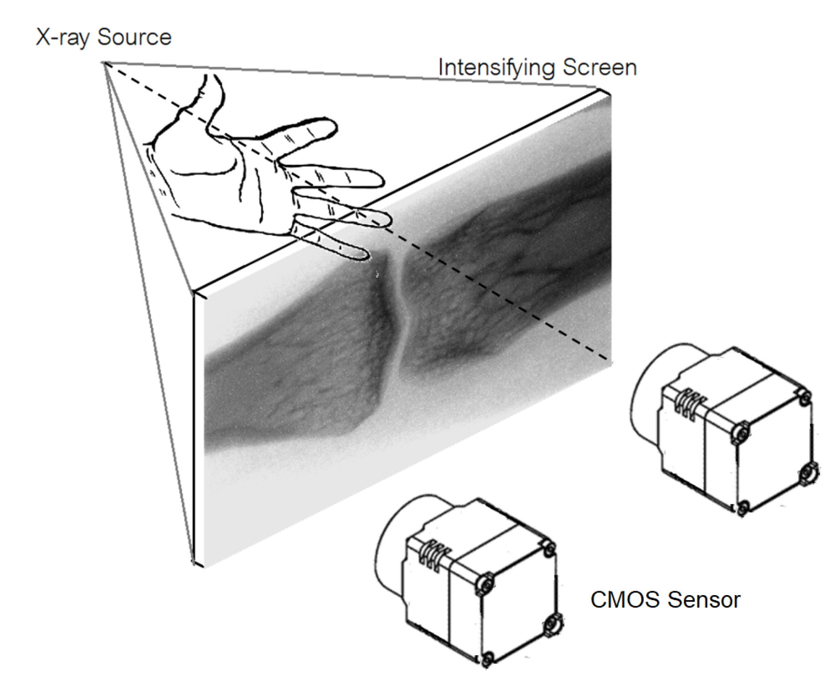 Dexa Scan, Bone Mineral Density Tool