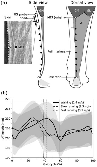 Elastic deformation mechanical model of the T-Probe extension tip in a