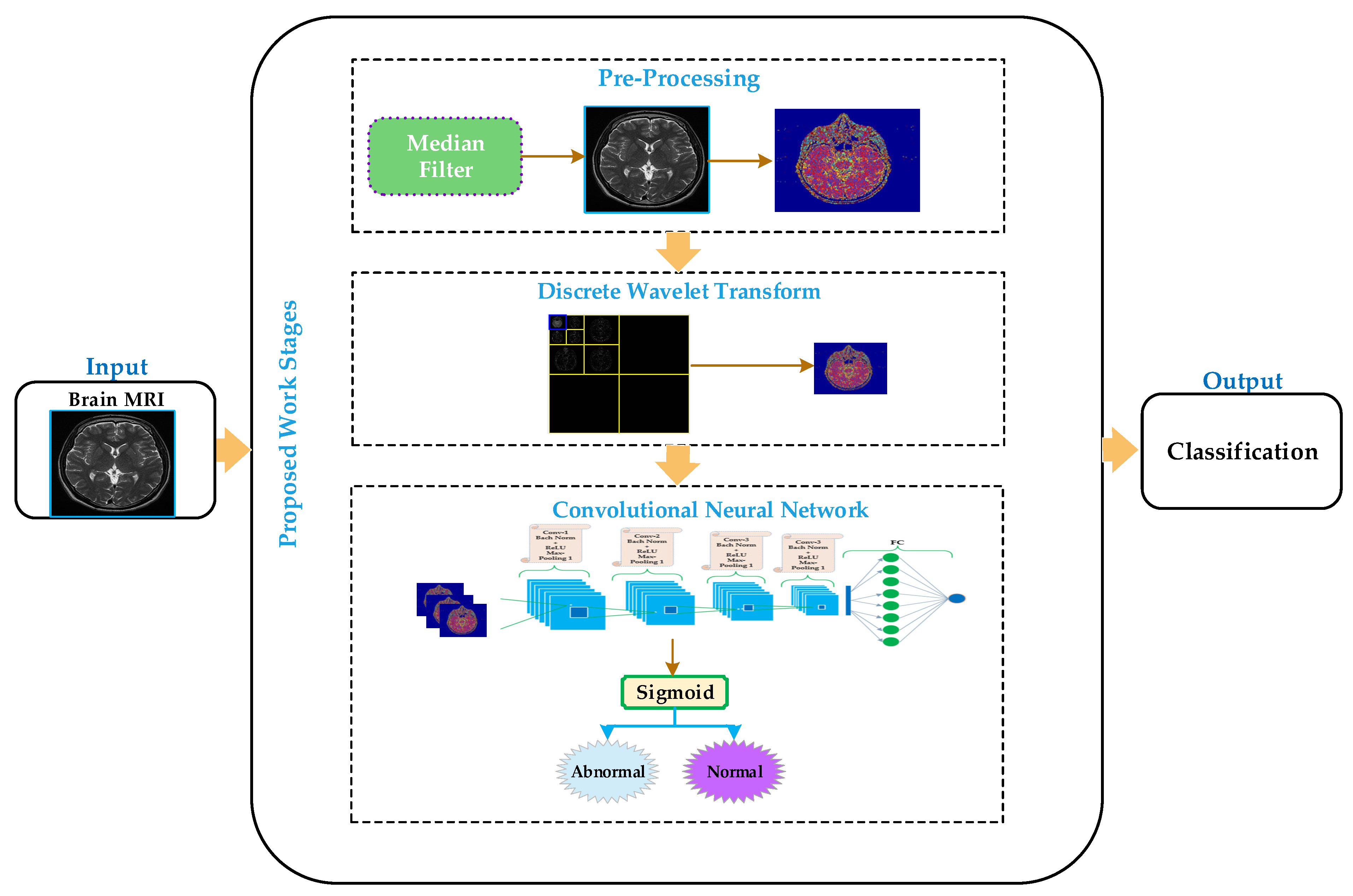 Sensors | Free Full-Text | An Efficient Methodology for Brain MRI  Classification Based on DWT and Convolutional Neural Network