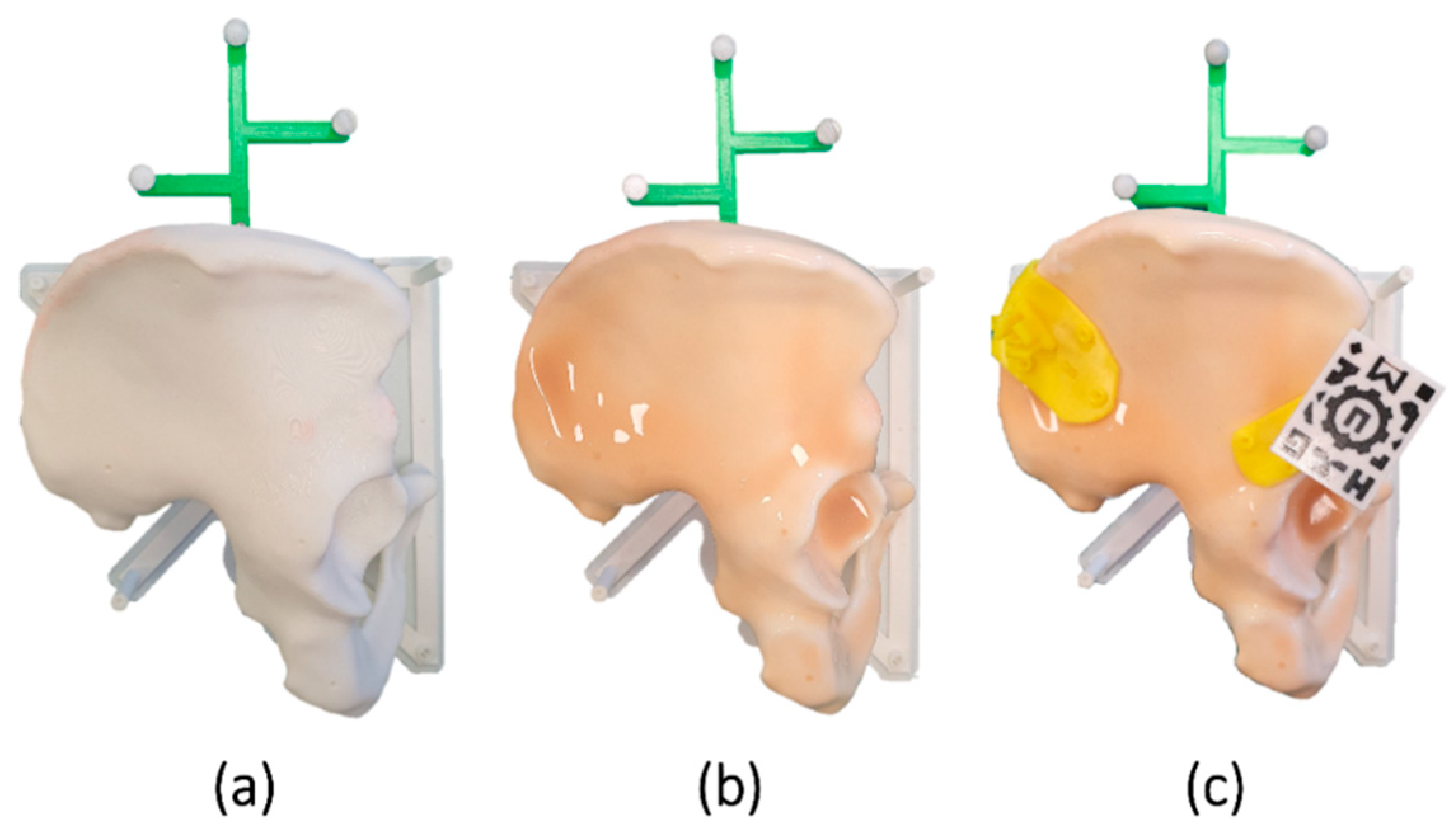 Sensors | Free Full-Text | Augmented Reality as a Tool to Guide PSI  Placement in Pelvic Tumor Resections | HTML