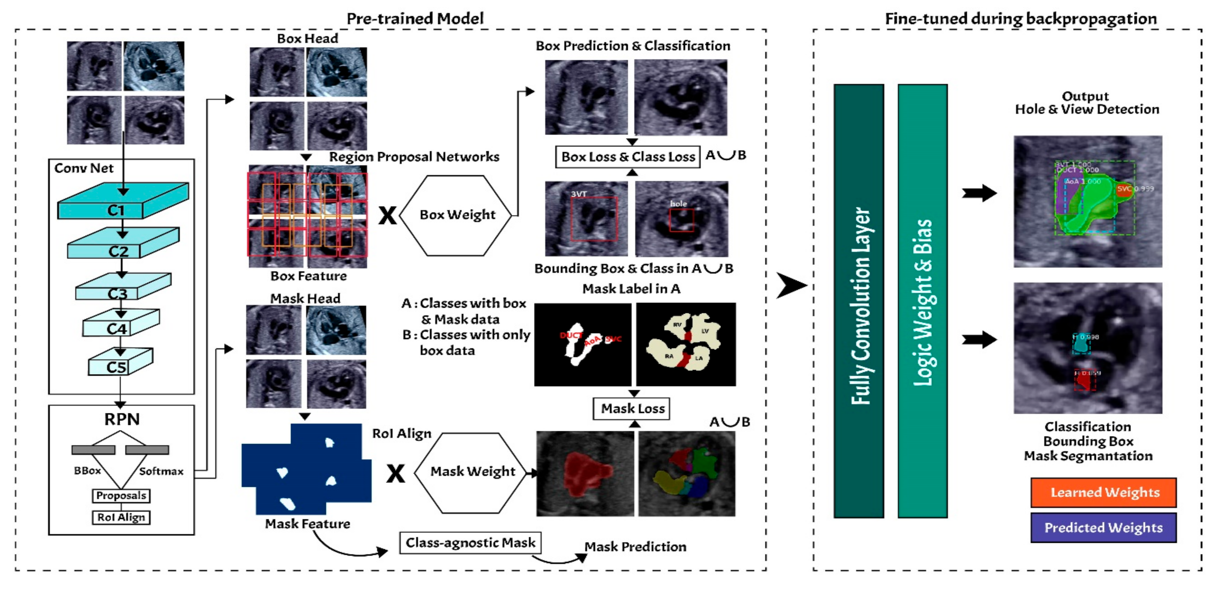 Sensors | Free Full-Text | Deep Learning-Based Computer-Aided Fetal  Echocardiography: Application to Heart Standard View Segmentation for  Congenital Heart Defects Detection
