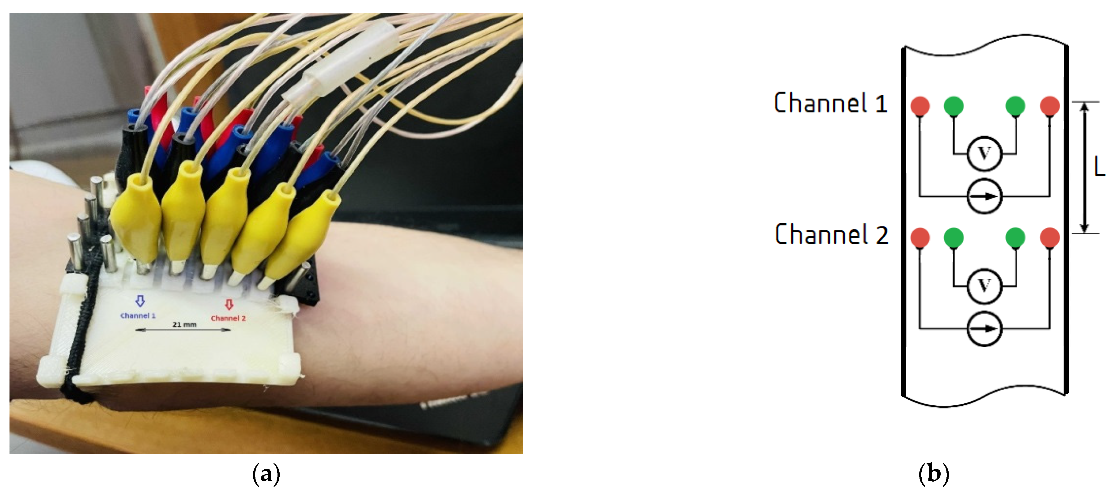 Sensors | Free Full-Text | Bio-Impedance Sensor for Real-Time Artery  Diameter Waveform Assessment | HTML
