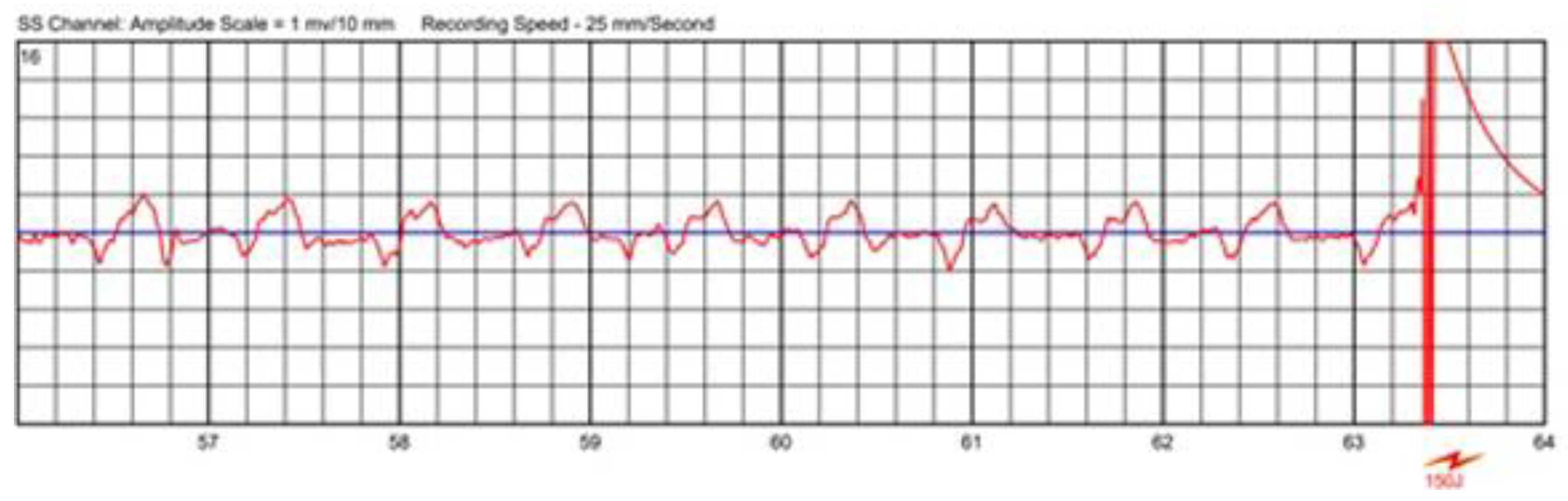 Sensors 22 00022 g008