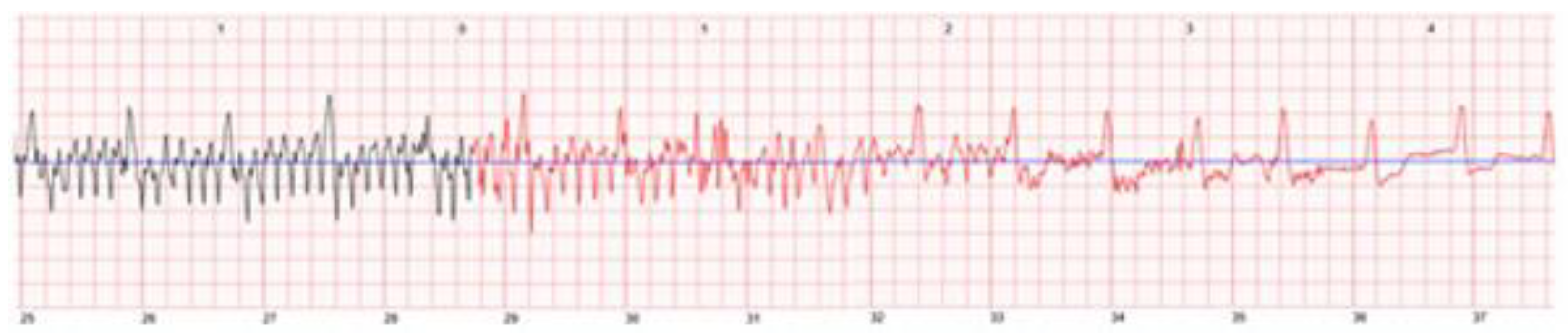 Sensors 22 00022 g009