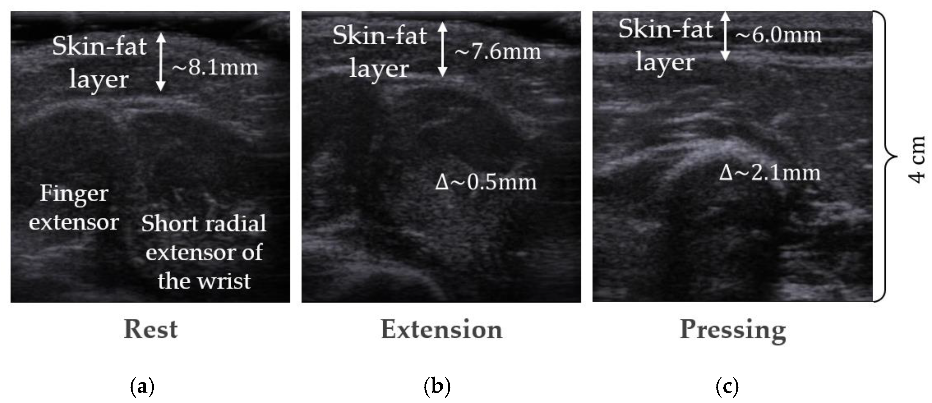 Sensors 22 00097 g015