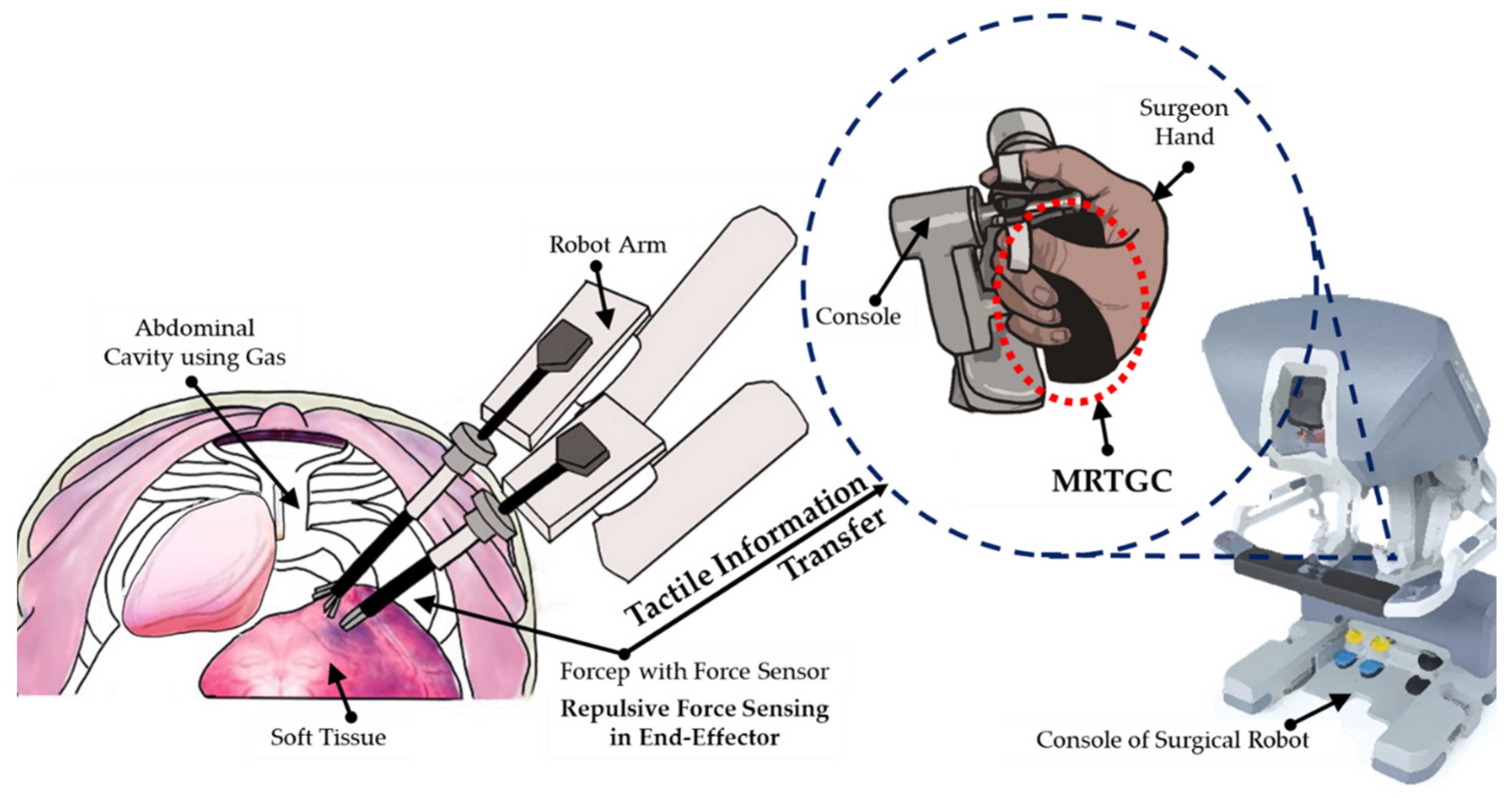 Sensors | Free Full-Text | A Cylindrical Grip Type of Tactile Device Using  Magneto-Responsive Materials Integrated with Surgical Robot Console: Design  and Analysis | HTML