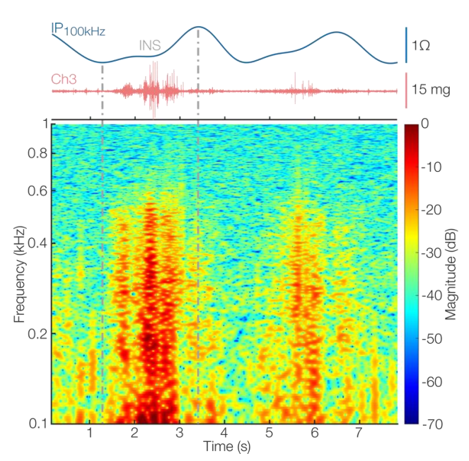 Sensors 22 01130 g007