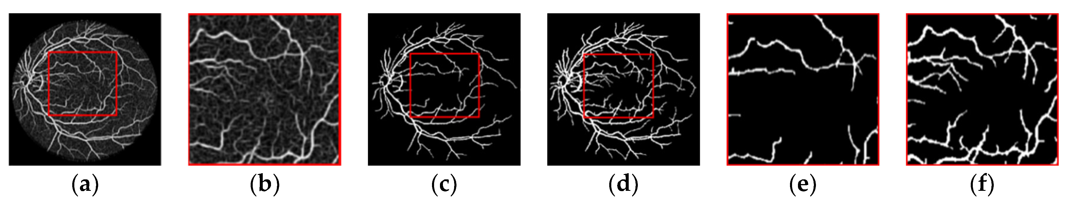 Sensors 22 01258 g005