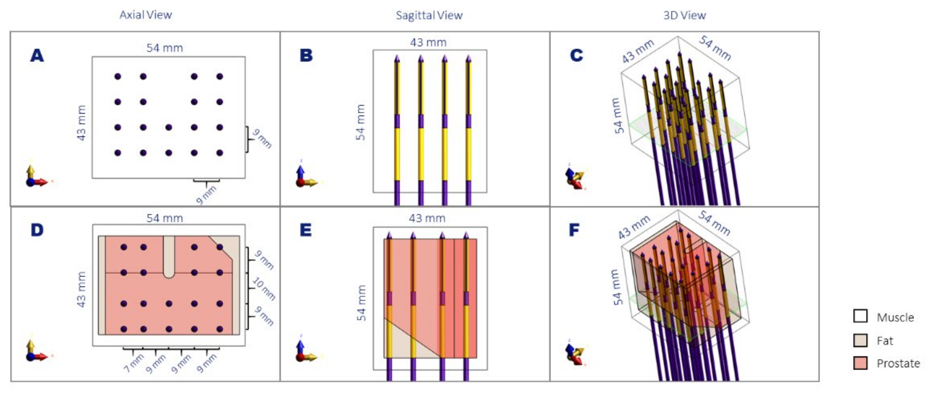 Sensors 22 01328 g003