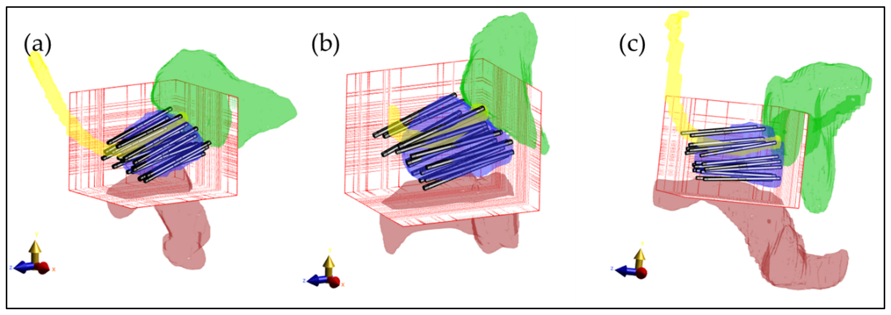 Sensors 22 01328 g007