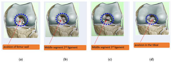 Sensors | Free Full-Text | Automated Knee MR Images Segmentation 