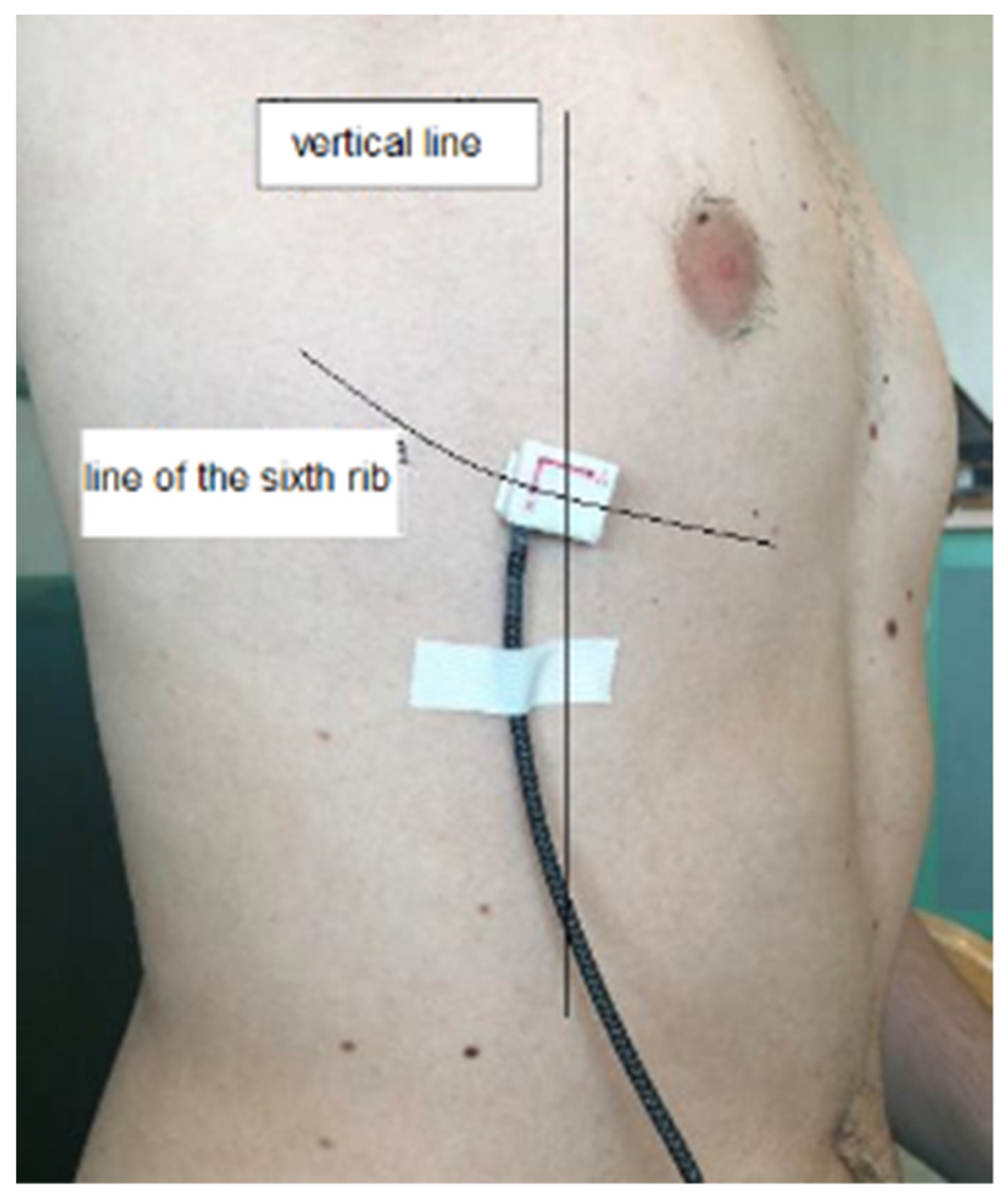 Sensors 22 01561 g005