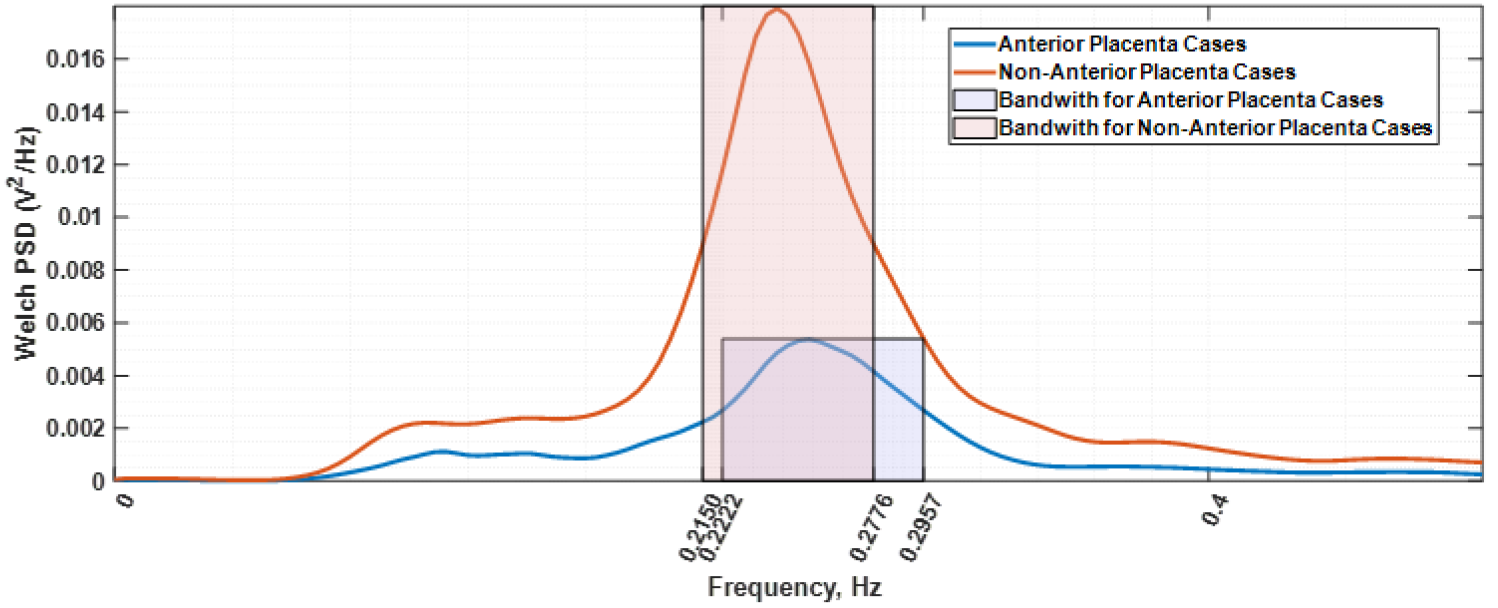 Sensors 22 01704 g002