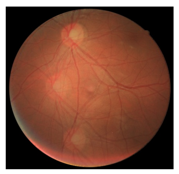 Sensors 22 02059 g014