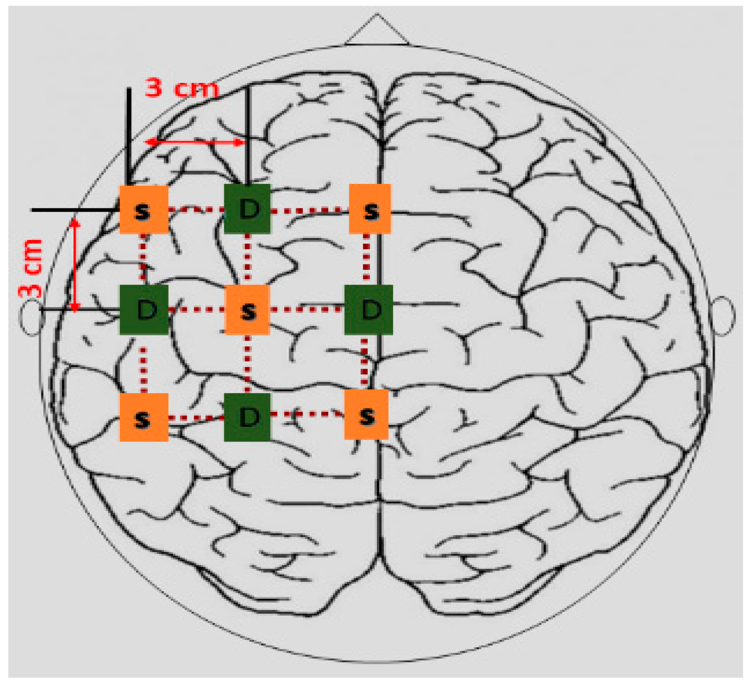 Sensors 22 02575 g004
