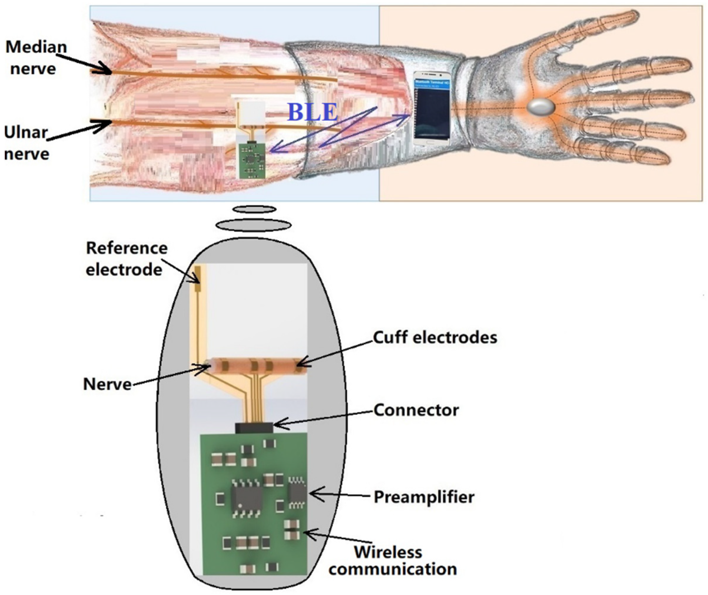 Sensors 22 02823 g002
