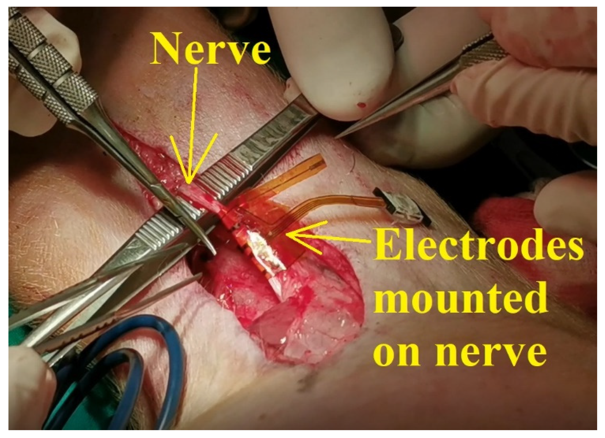 Sensors 22 02823 g011