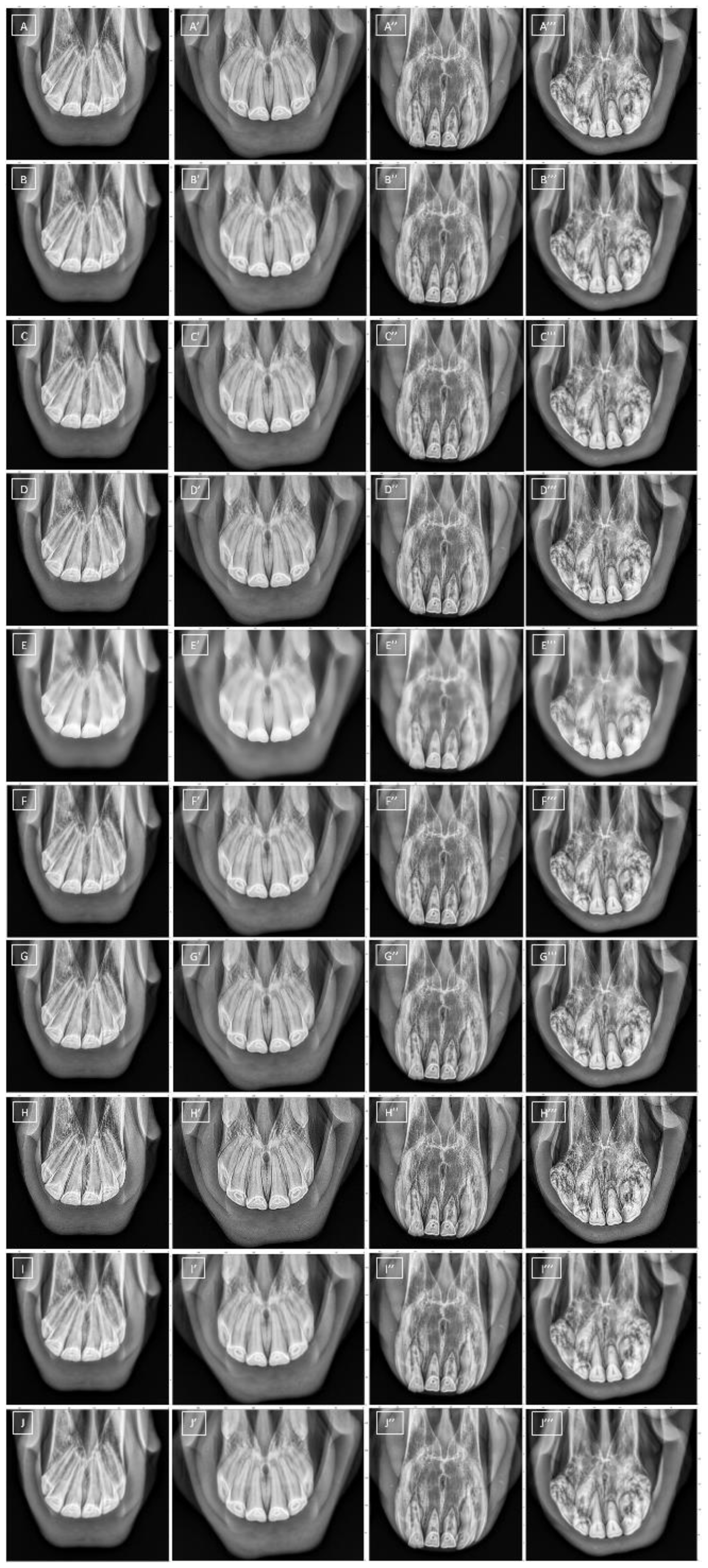 Sensors 22 02920 g002