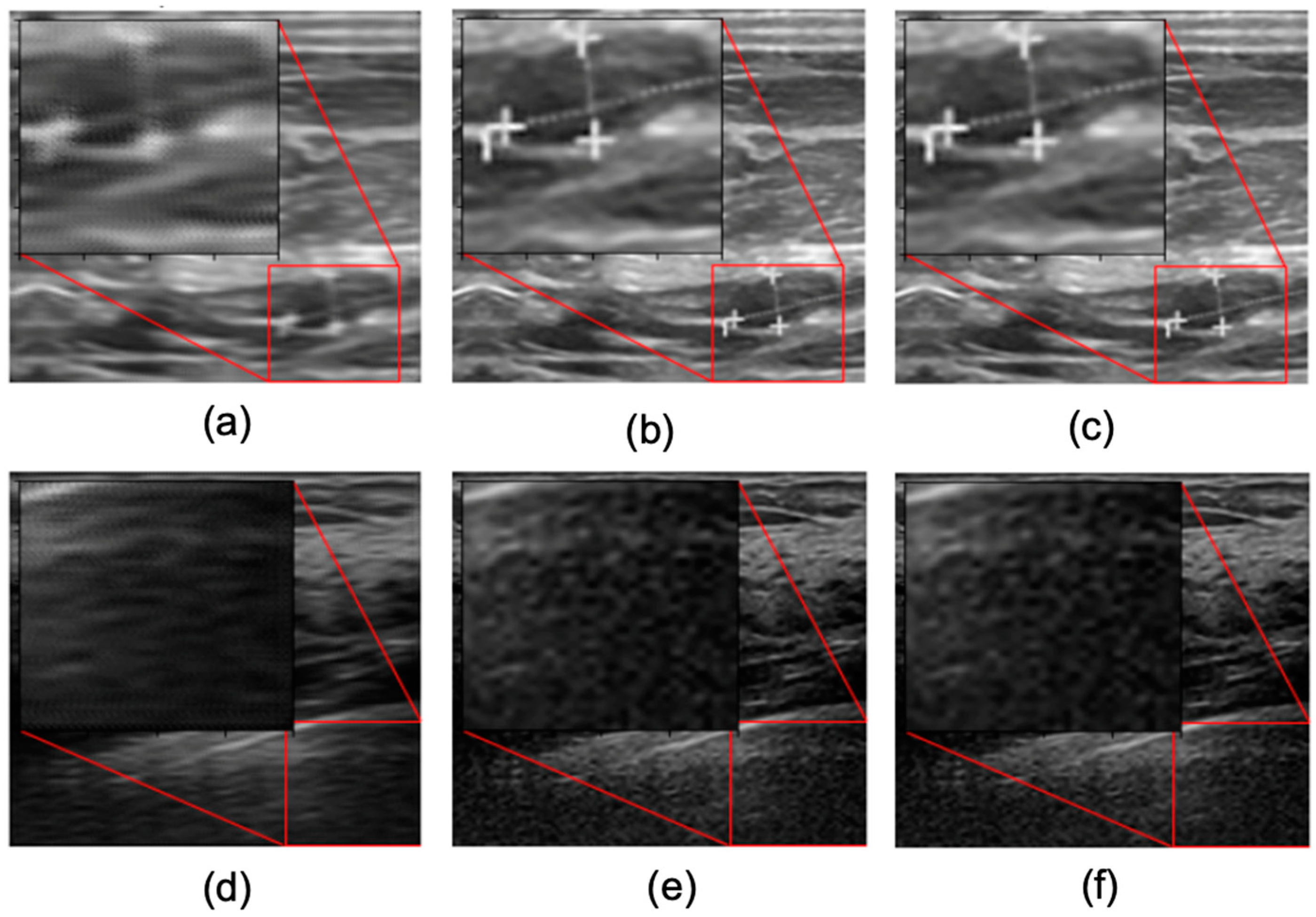 Sensors 22 03076 g005