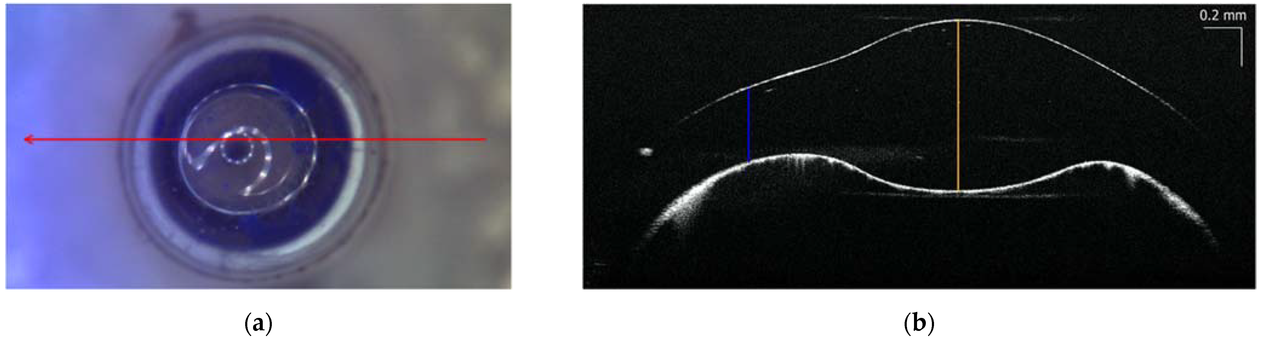 Sensors 22 03560 g003