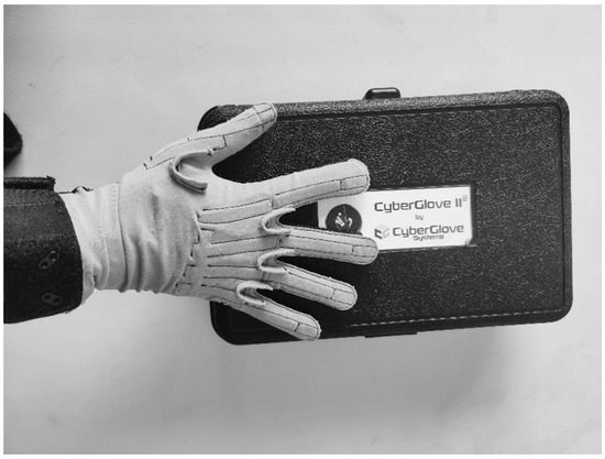 Smart glove can boost hand mobility of stroke patients - Today's Medical  Developments