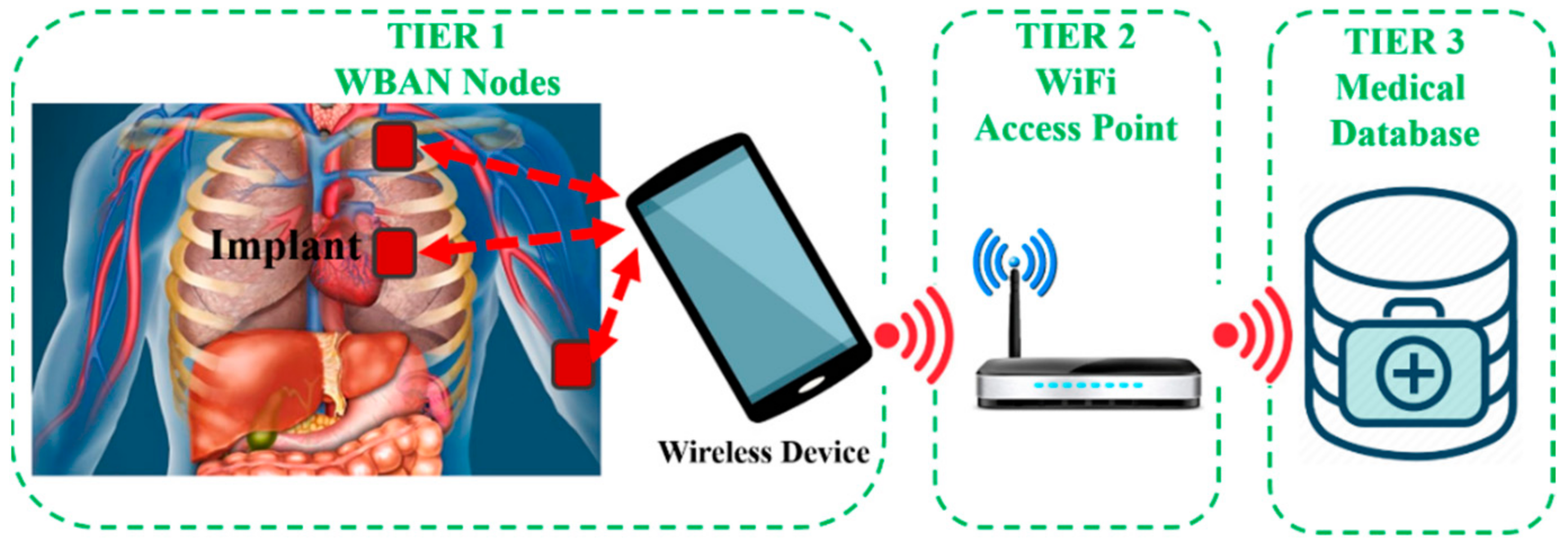 OSF Ventures joins early financing for first FDA-cleared wireless seizure  detection sensor