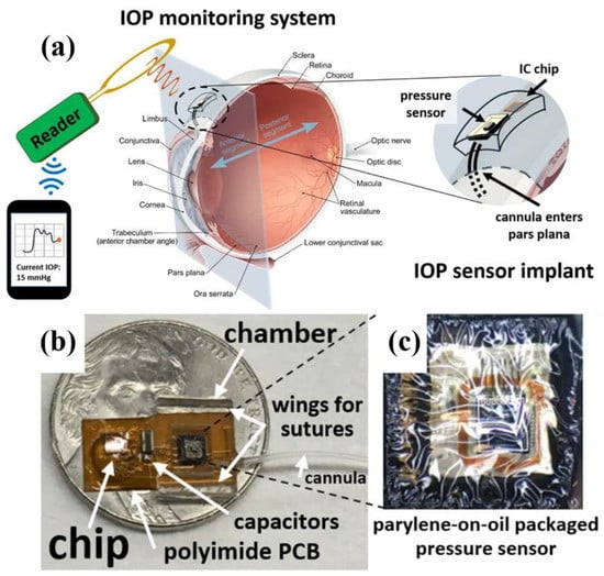 OSF Ventures joins early financing for first FDA-cleared wireless seizure  detection sensor