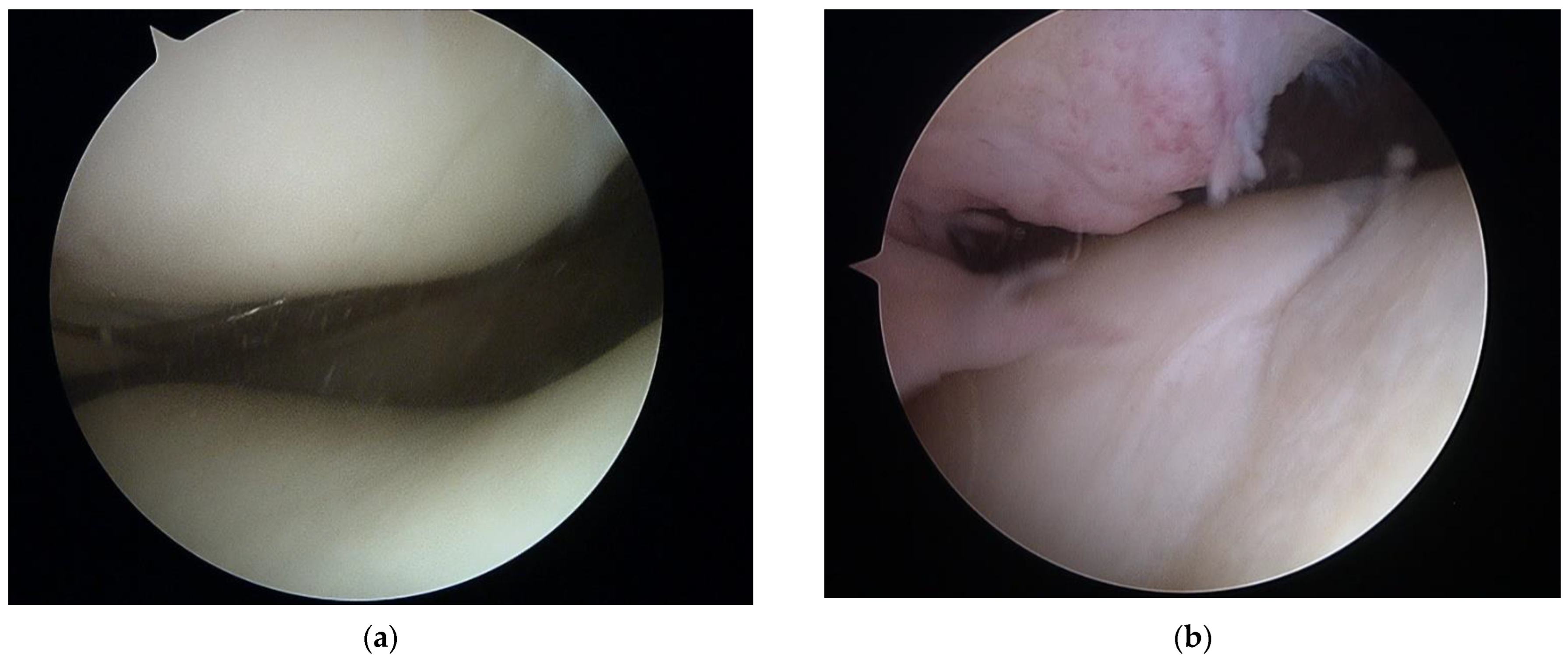 Sensors 22 03765 g001