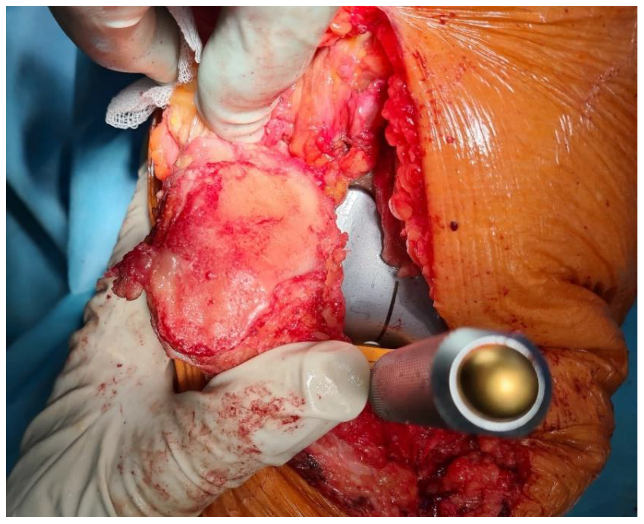 Sensors 22 03765 g002