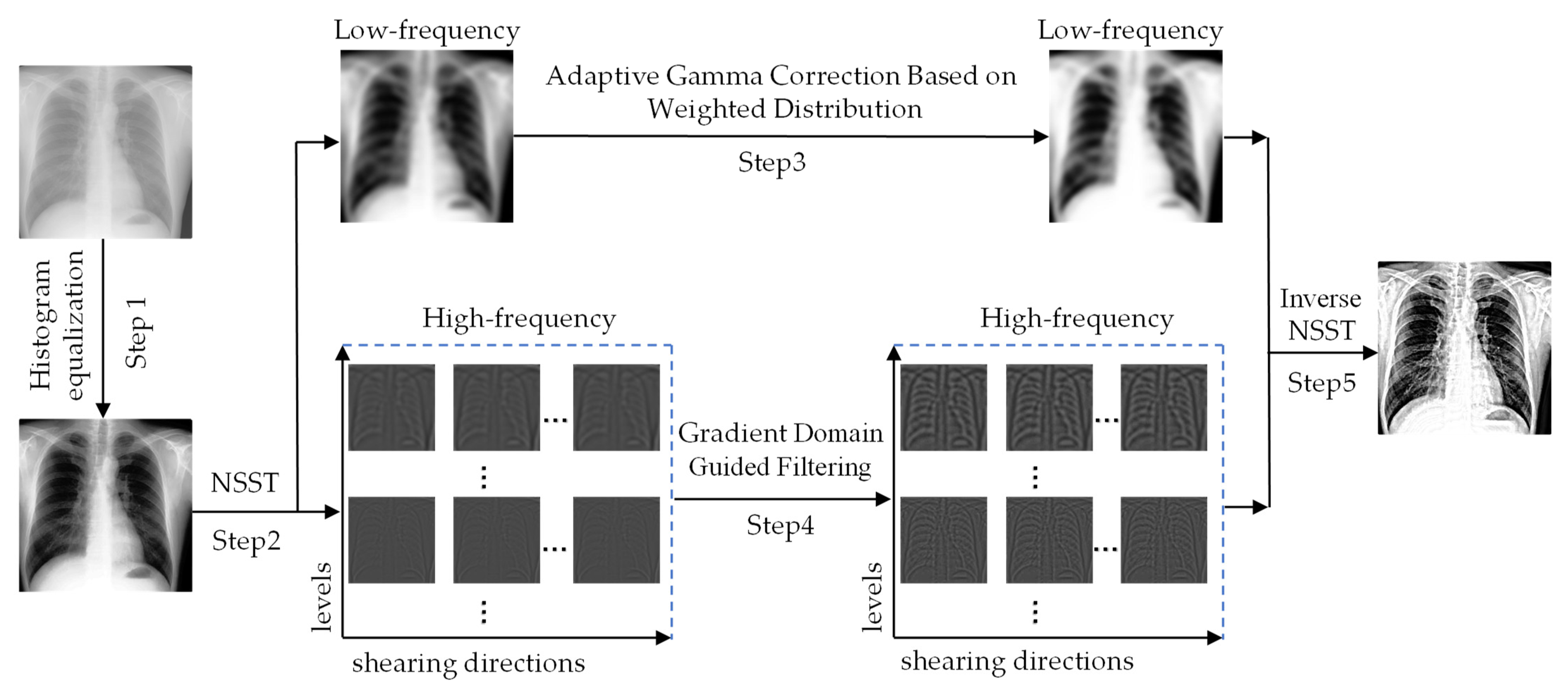 Sensors Free FullText Xray Image Enhancement Based on