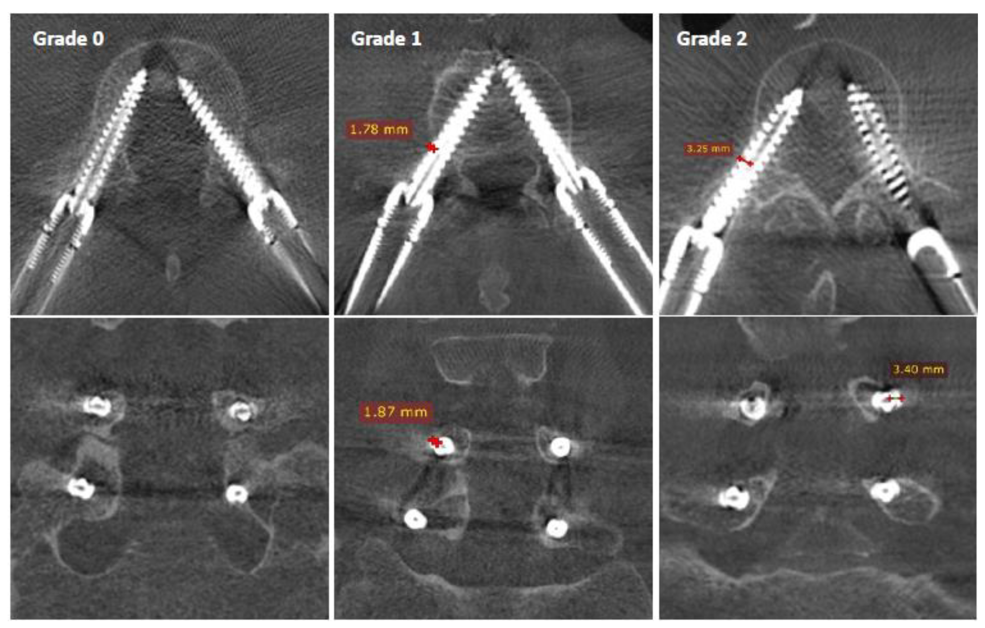 Sensors 22 04615 g003