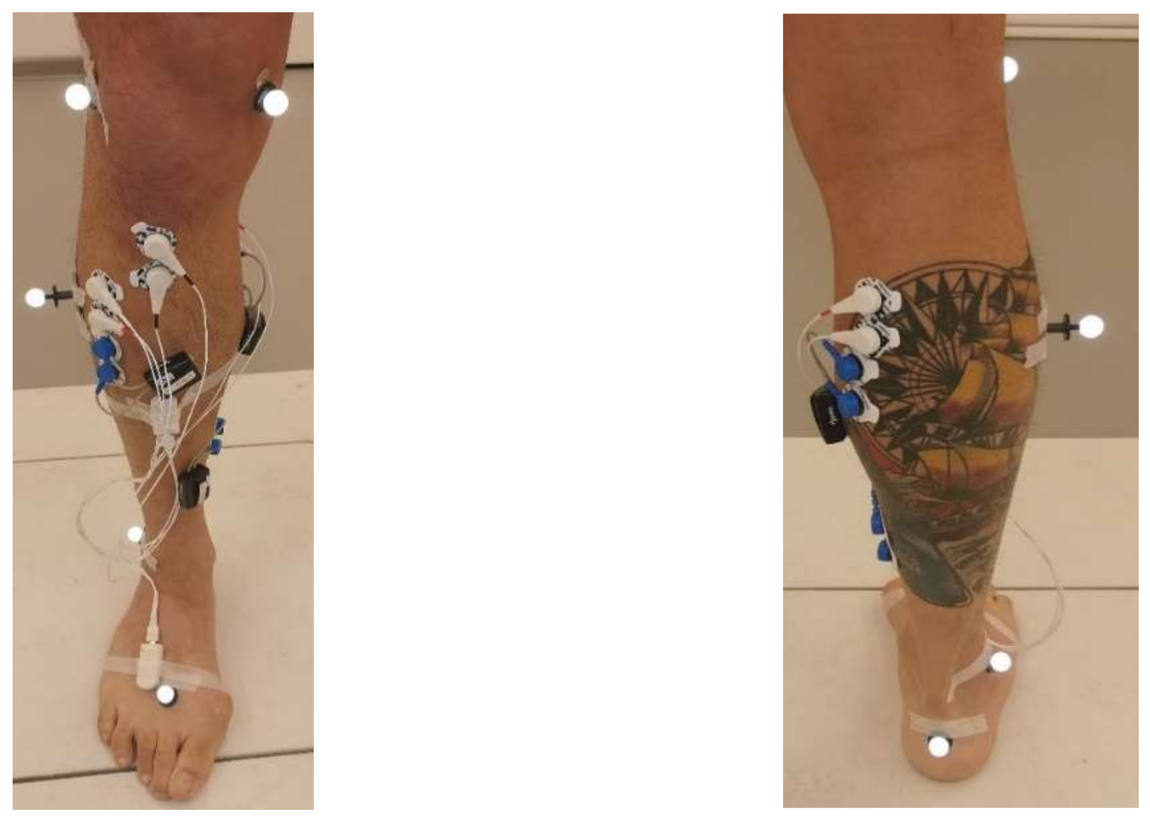 Image of the calf brace containing IMU, MMG, Vicon, and EMG