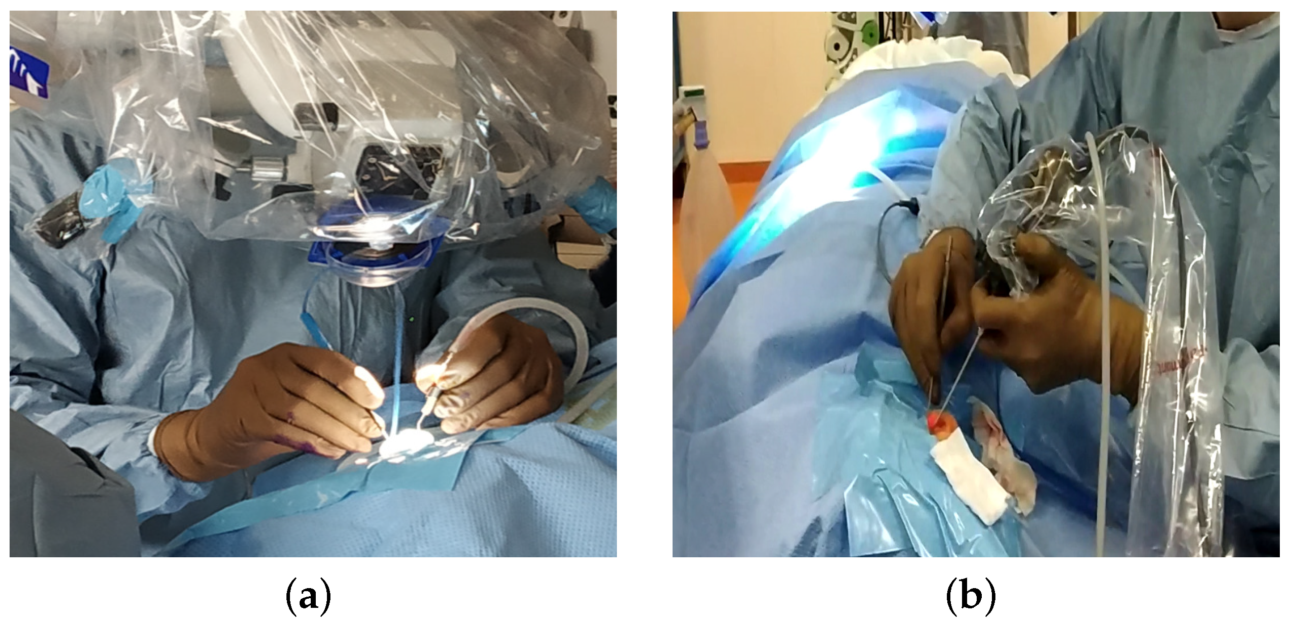Sensors | Free Full-Text | A New Robotic Endoscope Holder for Ear and Sinus  Surgery with an Integrated Safety Device