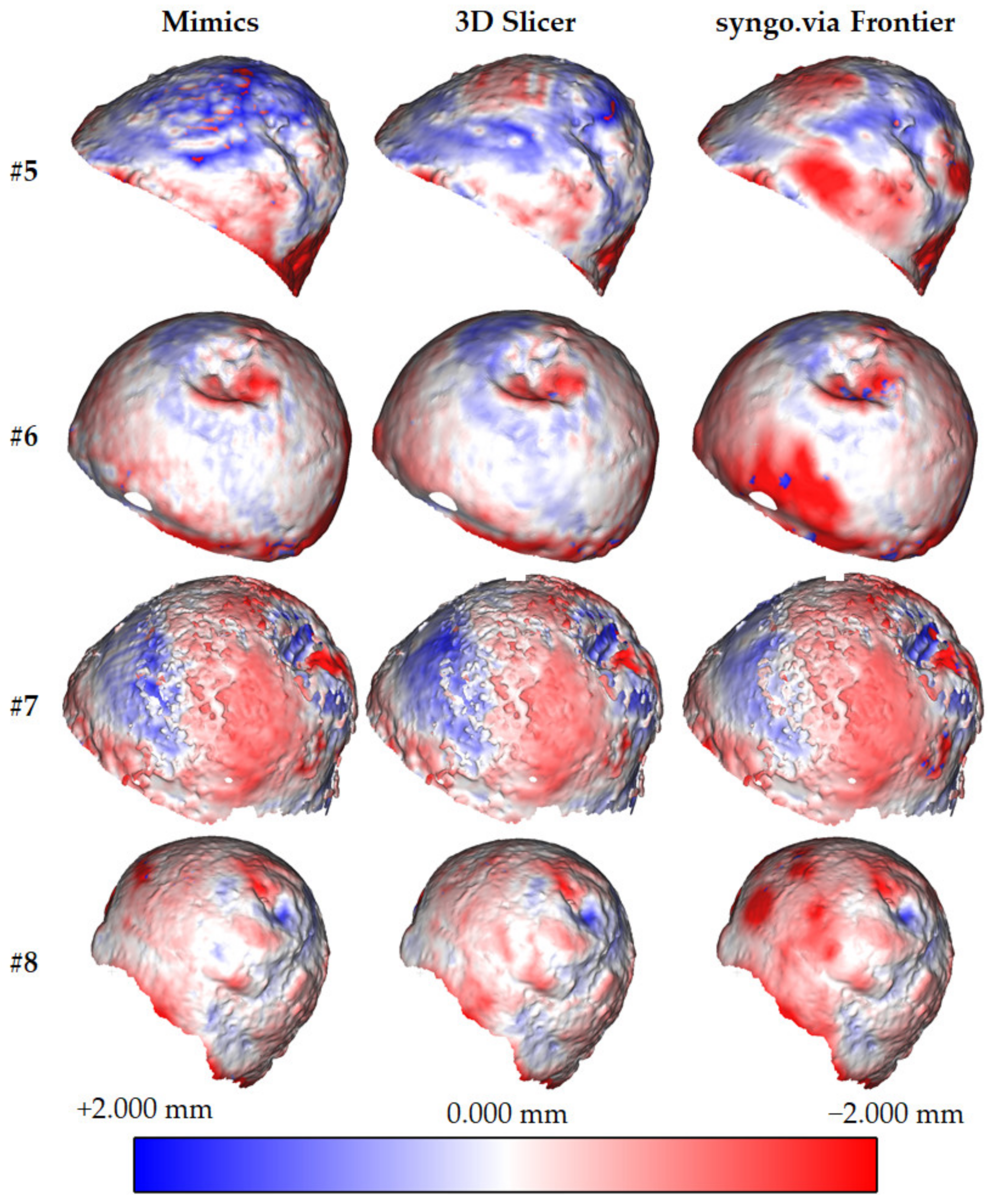 Sensors 22 05242 g005