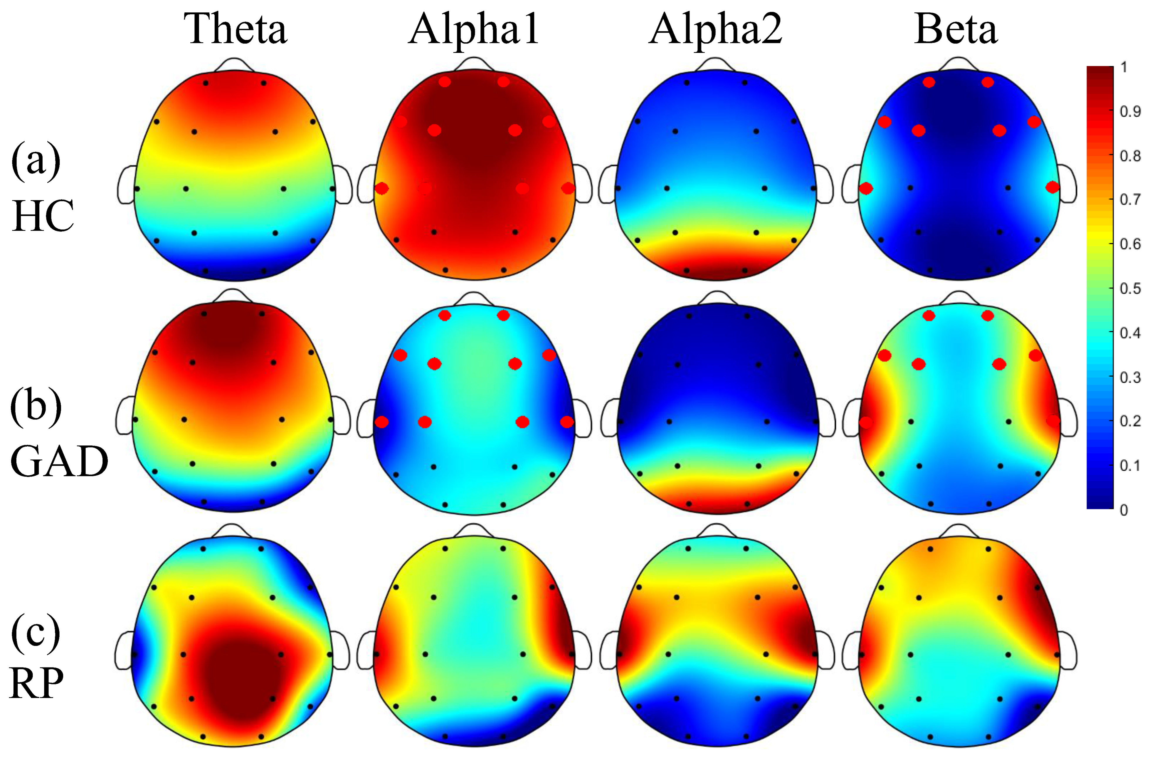 Sensors | Free Full-Text | Aberrated Multidimensional EEG Characteristics  in Patients with Generalized Anxiety Disorder: A Machine-Learning Based  Analysis Framework