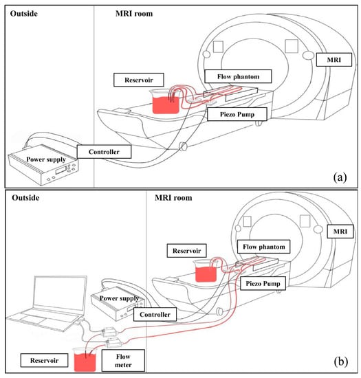 Sensors | Free Full-Text | MRI-Compatible Microcirculation System Using  Ultrasonic Pumps for Microvascular Imaging on 3T MRI