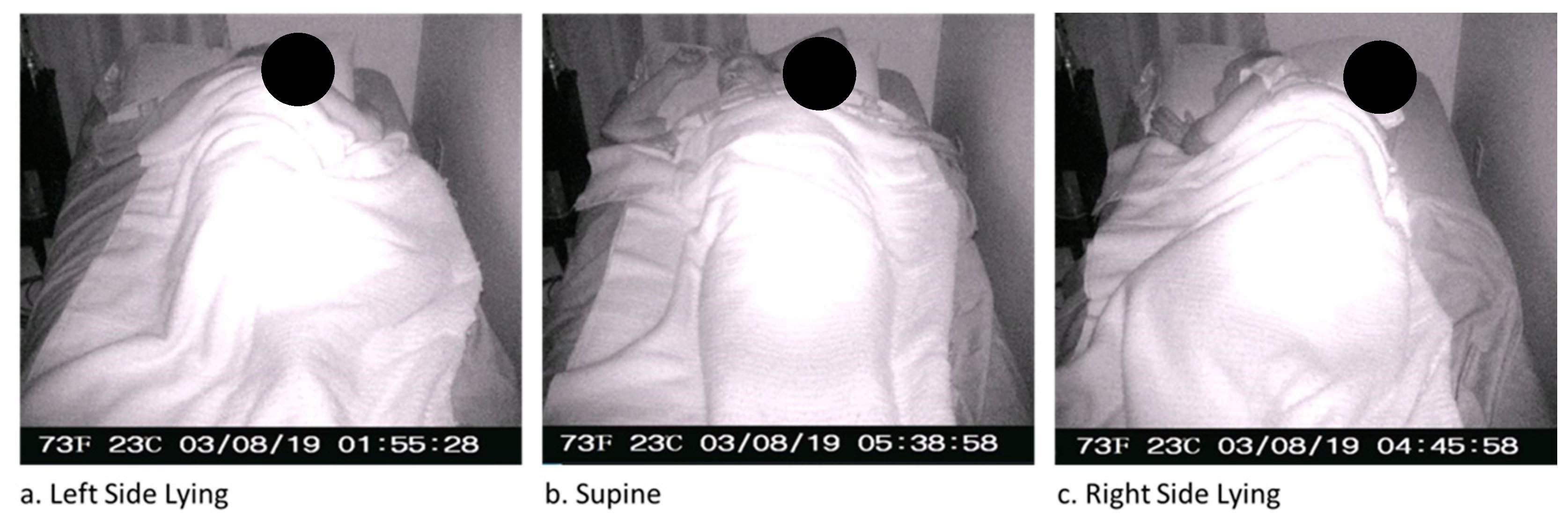 Sacrum Offloading & Positioning Archives - PRIMO INC