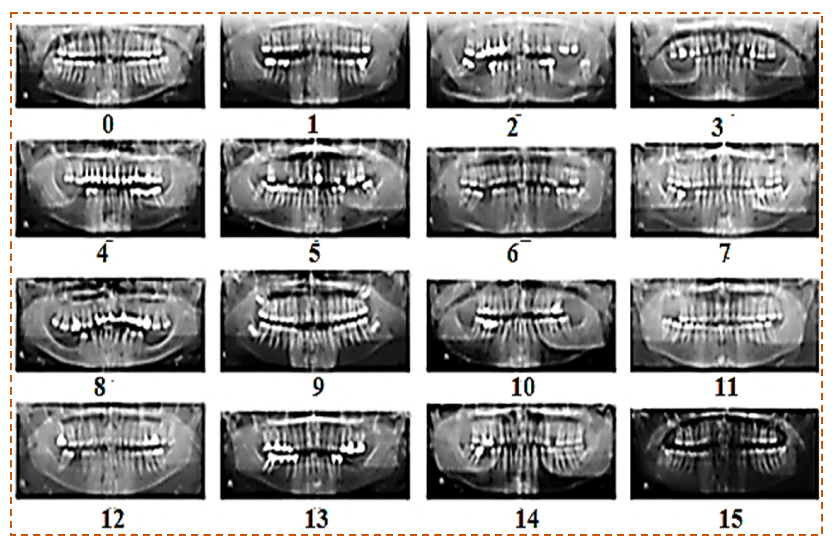 Sensors Free Full Text Deep Learning Models For Classification Of Dental Diseases Using