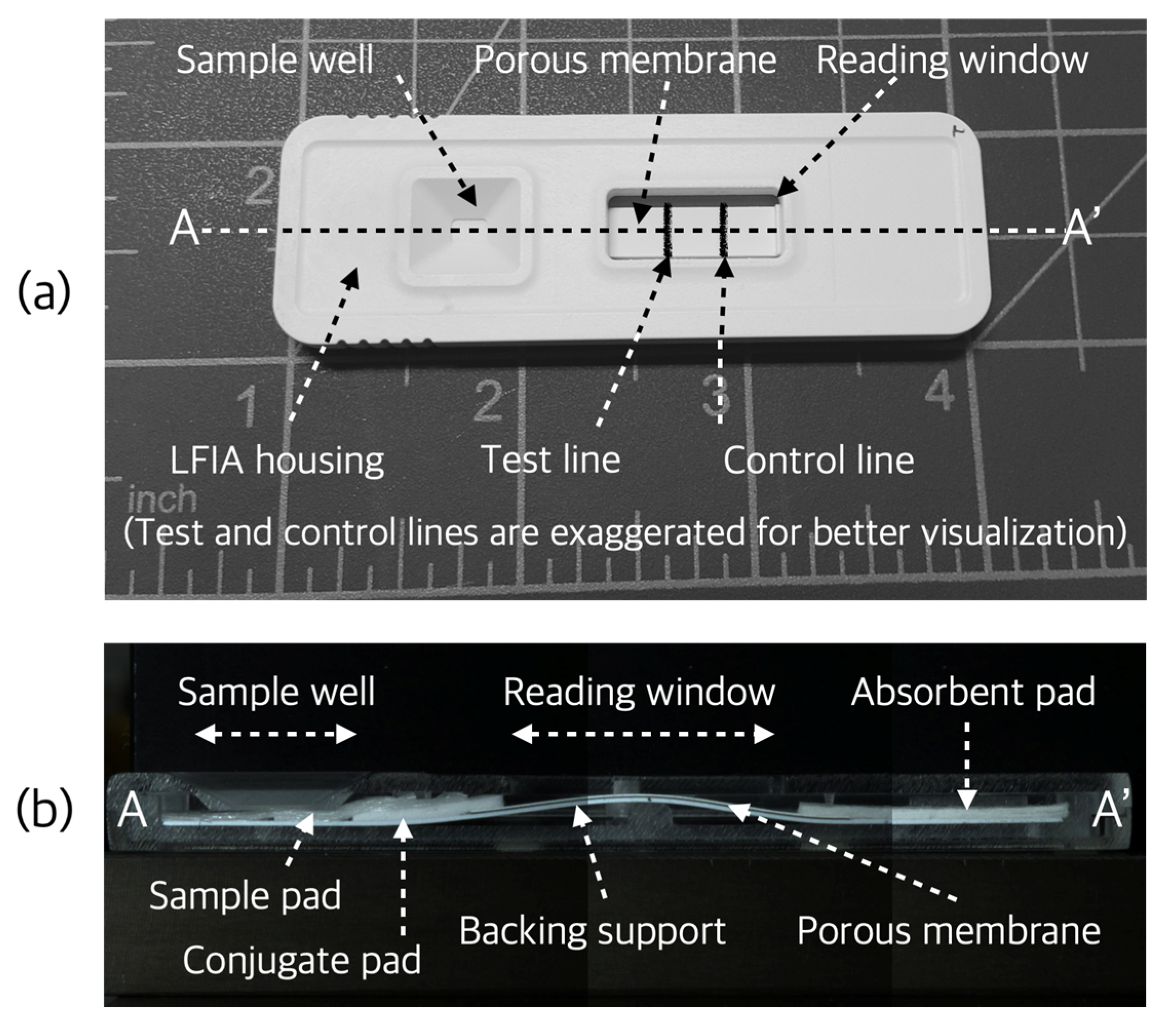 Sensors | Free Full-Text | Lateral Flow Immunoassay Reader Technologies for  Quantitative Point-of-Care Testing