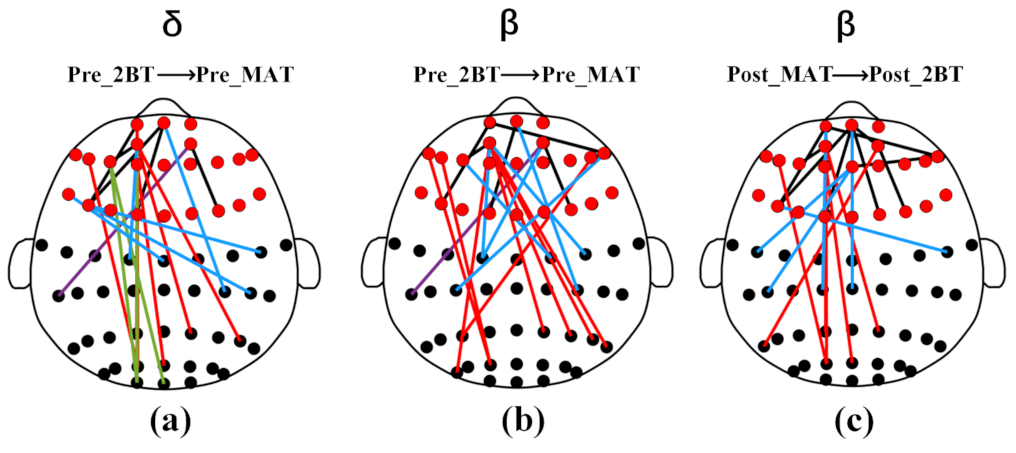 Sensors | Free Full-Text | Reorganization Of Brain Functional Network ...