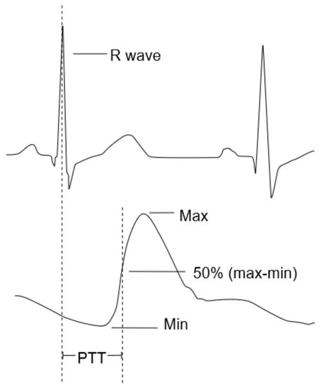 Sensors | Free Full-Text | Measuring Suite for Vascular Response ...