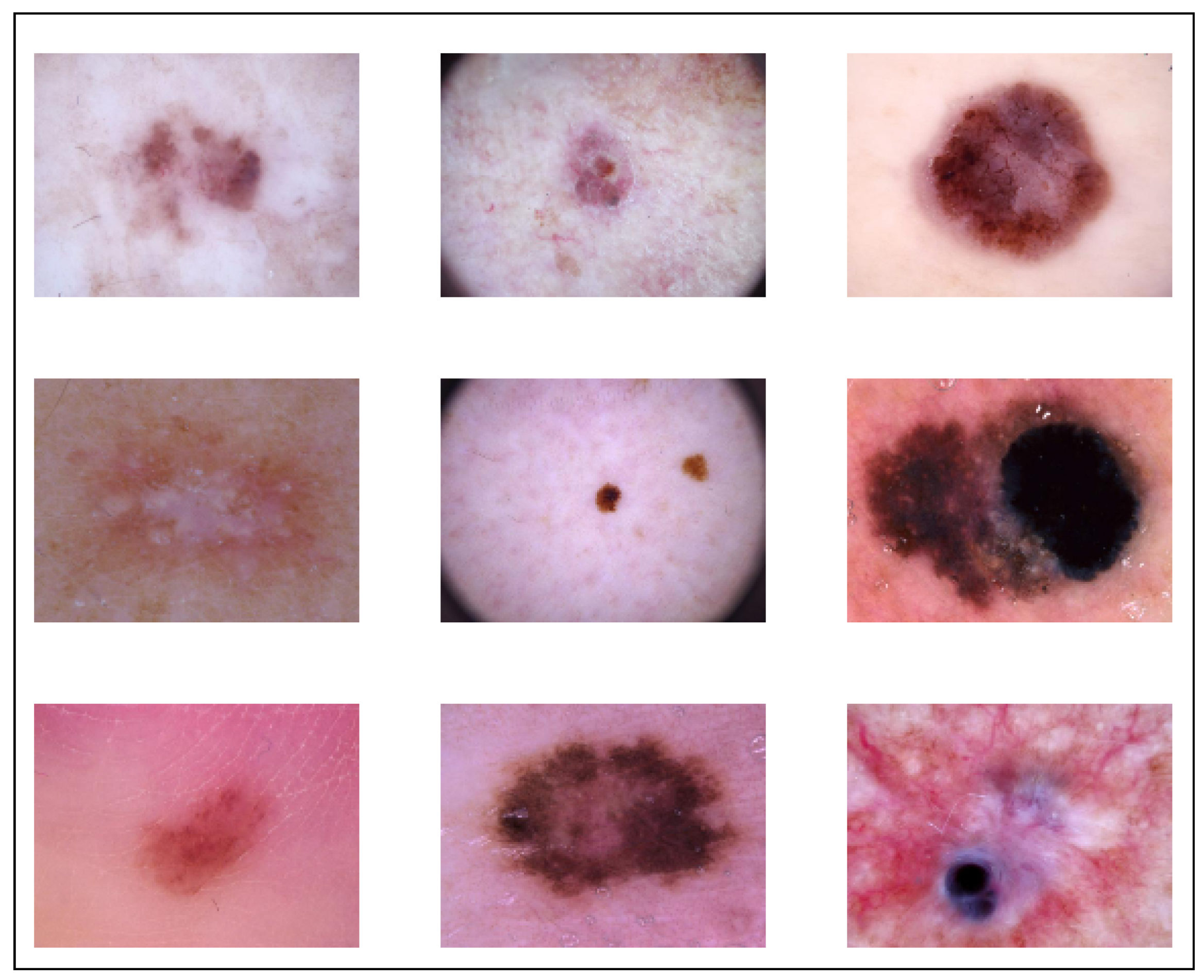 Sensors | Free Full-Text | Multi-Class Skin Lesions Classification ...