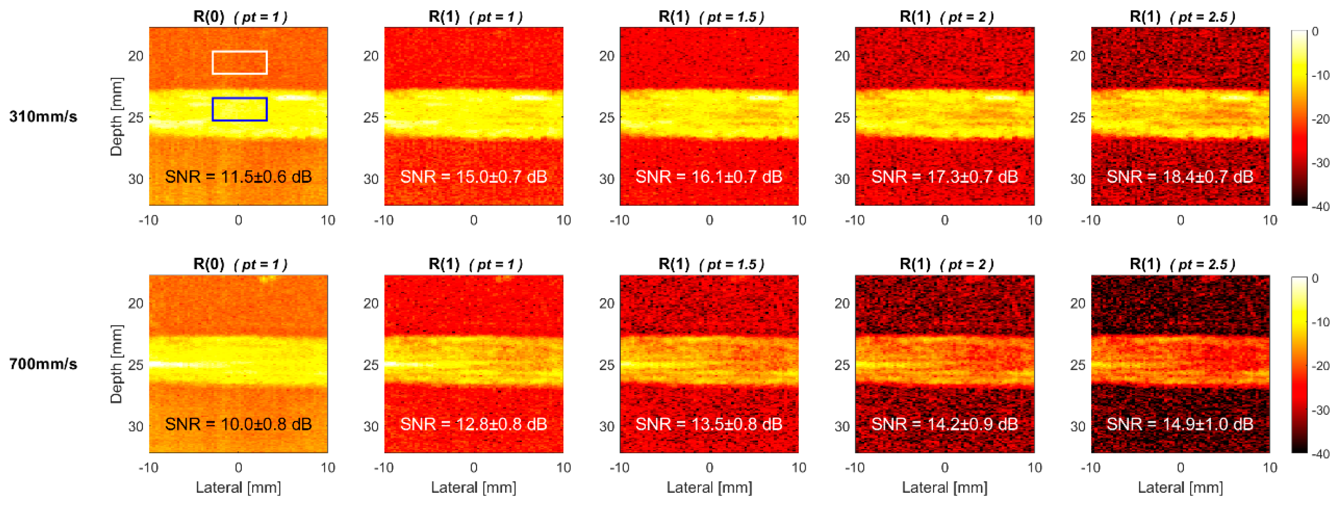 Non-contrast power Doppler ultrasound imaging for early assessment