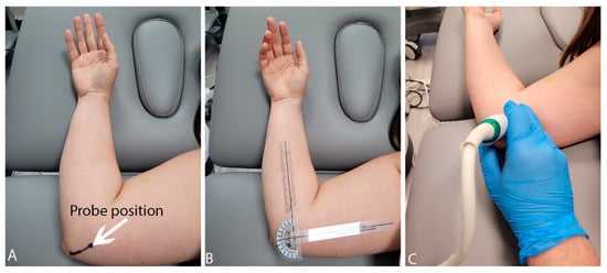 Sensors | Free Full-Text | Changes in Ultrasound Measurements of the ...