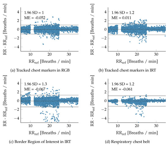 Breathing Patterns! Cheyne Stokes, Biot's, Kussmaul's, Apnea, and more 