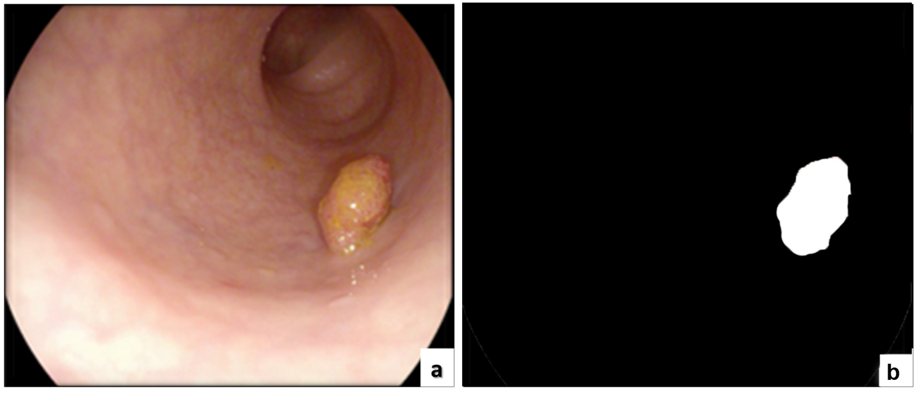 Sensors 22 09250 g008 Sensors 22 09250 g008