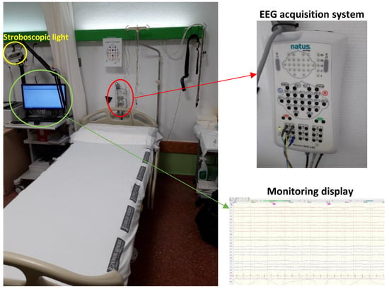 Personal Epilepsy Alarms - Epiview - Epilepsy Alarms & Monitoring UK &  Europe