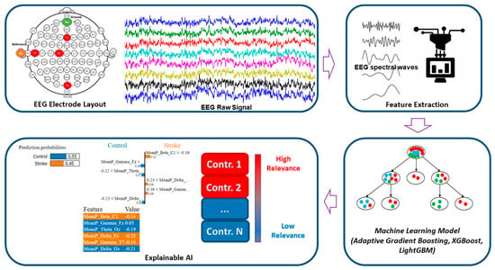 Sensors | Free Full-Text | Explainable Artificial Intelligence Model ...