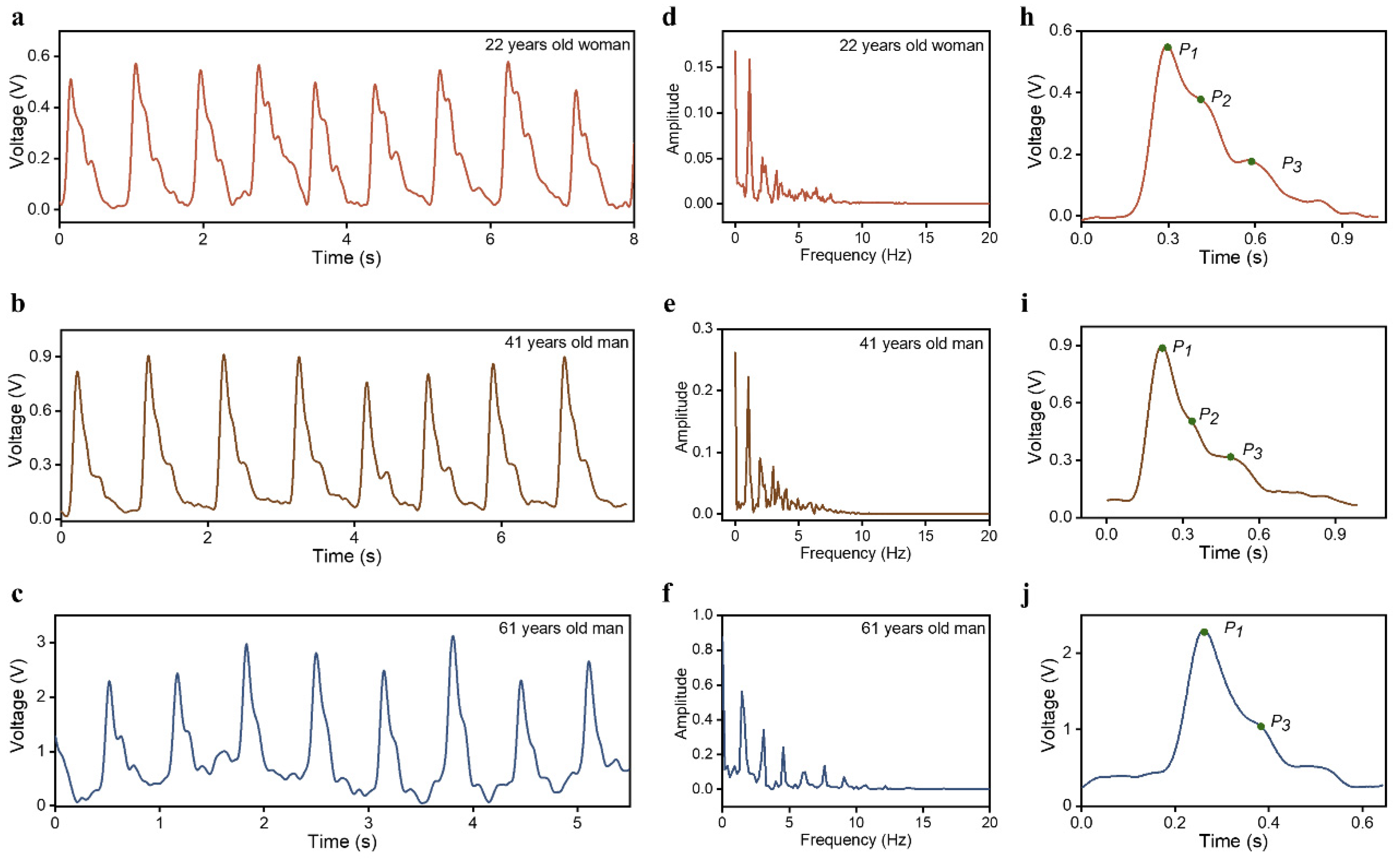 Sensors 23 00045 g005