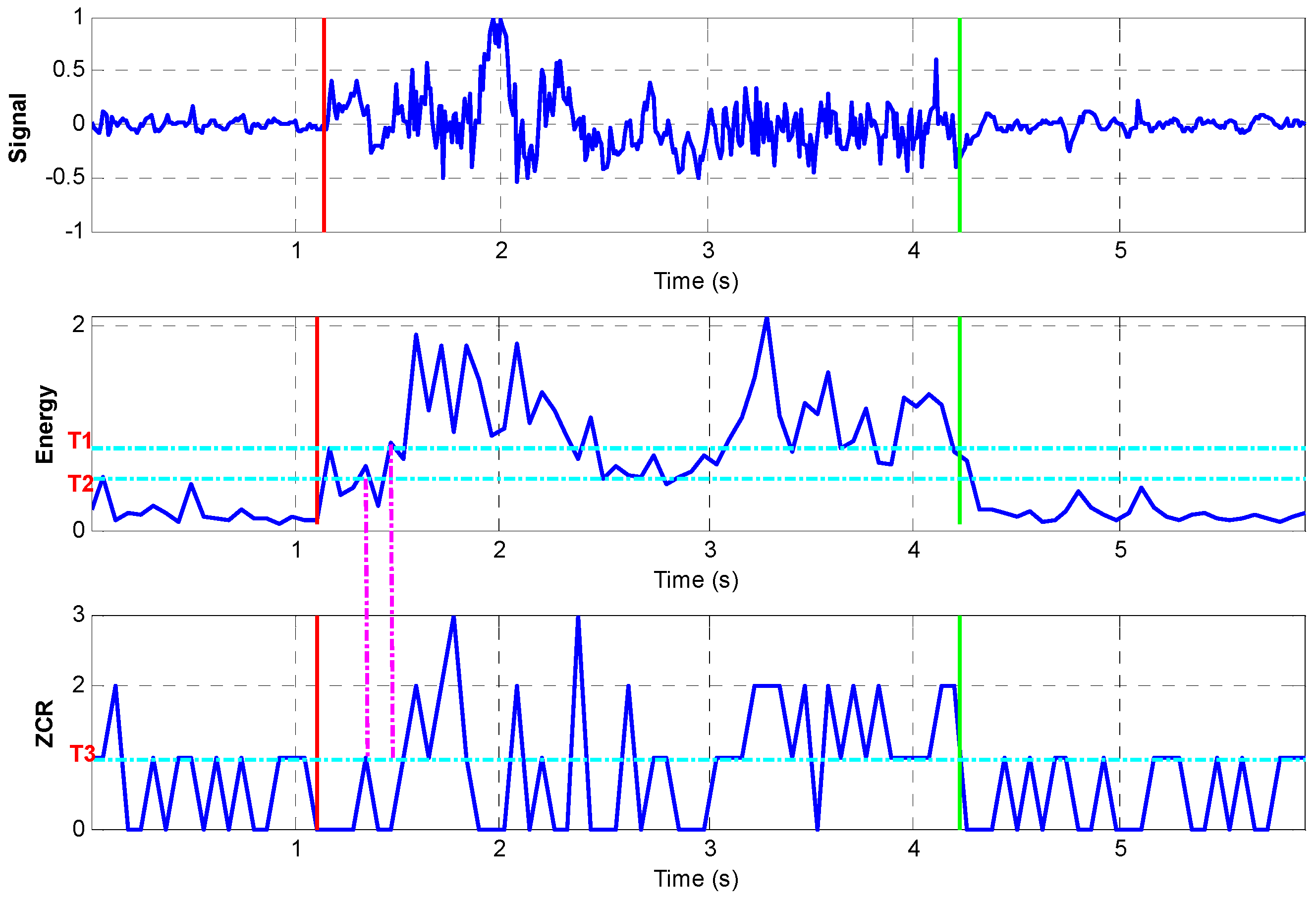 PDF) Upper Limb Position Tracking with a Single Inertial Sensor Using Dead  Reckoning Method with Drift Correction Techniques